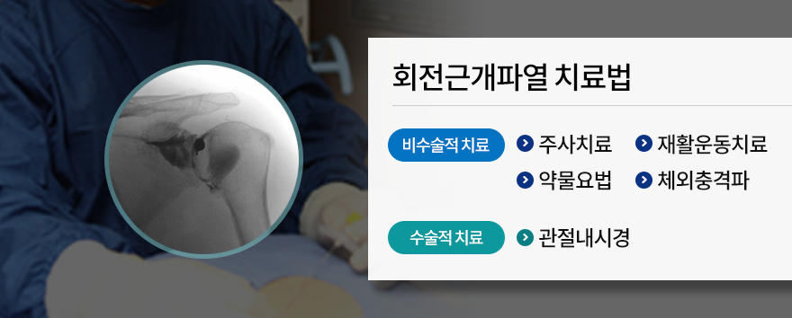 회전근개파열 치료법